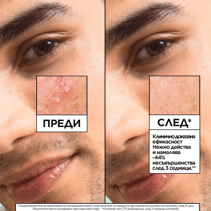 Серум против несъвършенства Salicylic, 30 ml