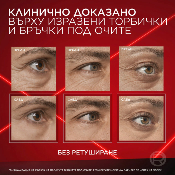 Гел за околоочен контур Eye Bag Instant Eraser, 15 ml
