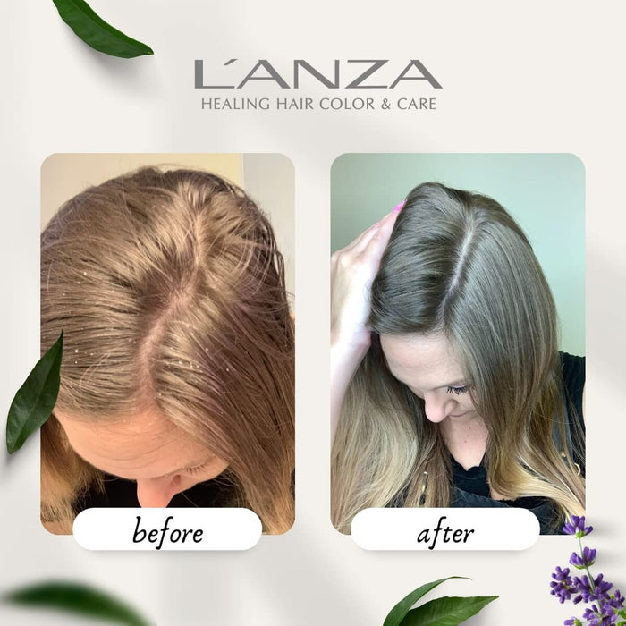 Балсам L'ANZA Healing Remedy