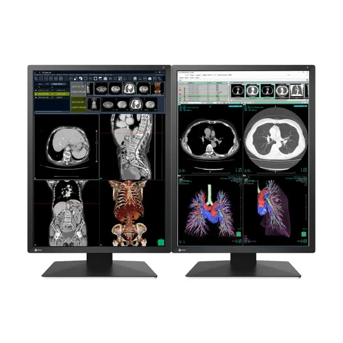 Медицински монитор EIZO Radi Force RX270 - 21.3’’ инч 2MP