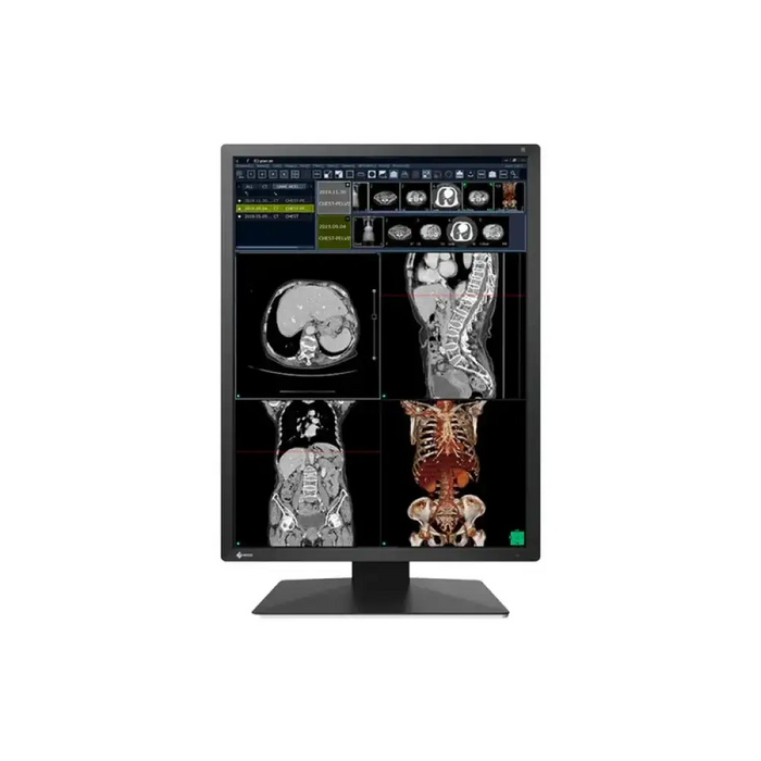 Медицински монитор EIZO Radi Force RX270 - 21.3’’ инч 2MP