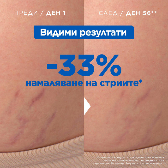Масло против стрии, 100 ml