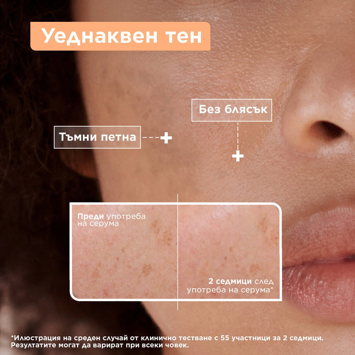 Серум против тъмни петна Anti-Dark Spot, 30 ml