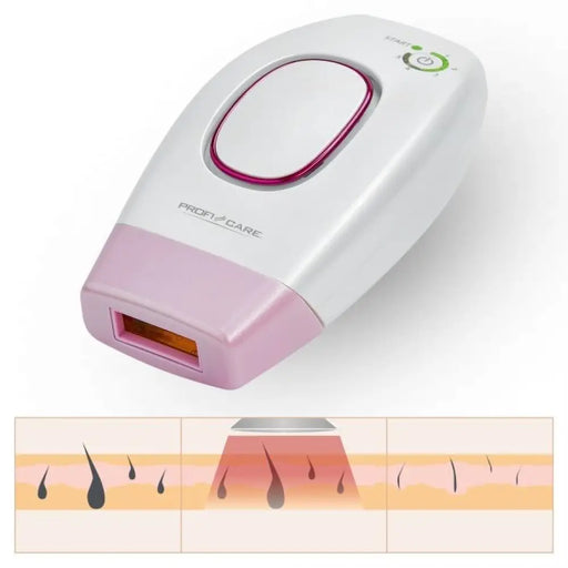 ProfiCare PC-IPL 3024 Розов Бял