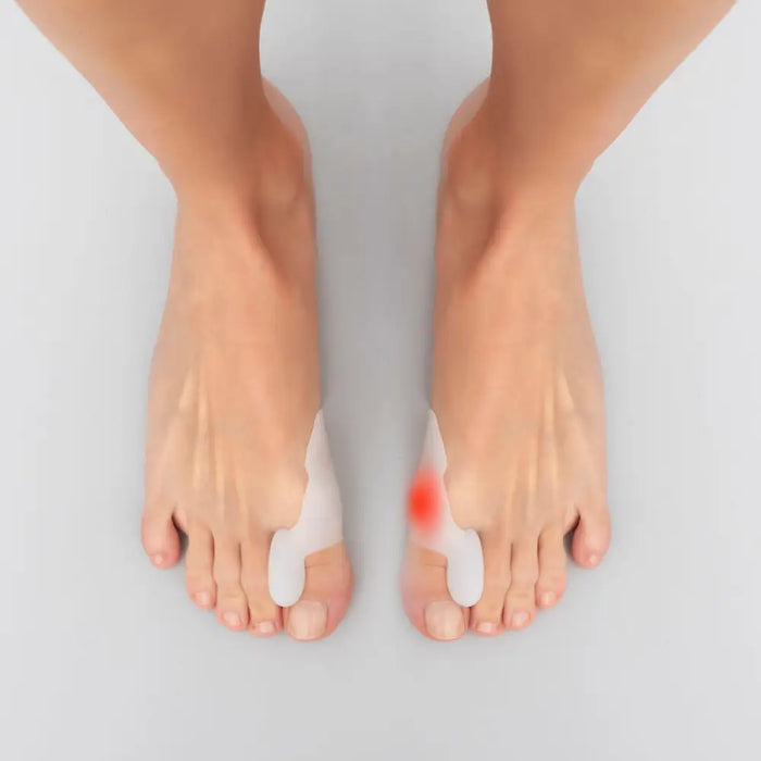 Силиконов Коректор Протектор за Буньони Bunilief