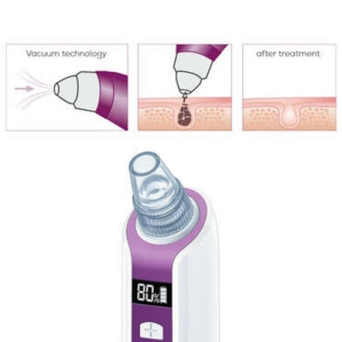 Уред за лице Beurer FC 41 Deep pore cleanser