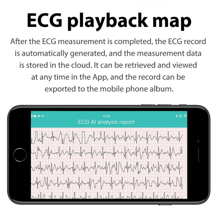 Смарт часовник Vektros VR26 Обаждане през часовника ECG PPG 